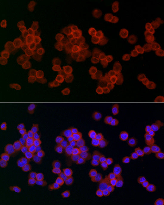 Lysozyme (LYZ) Rabbit pAb
