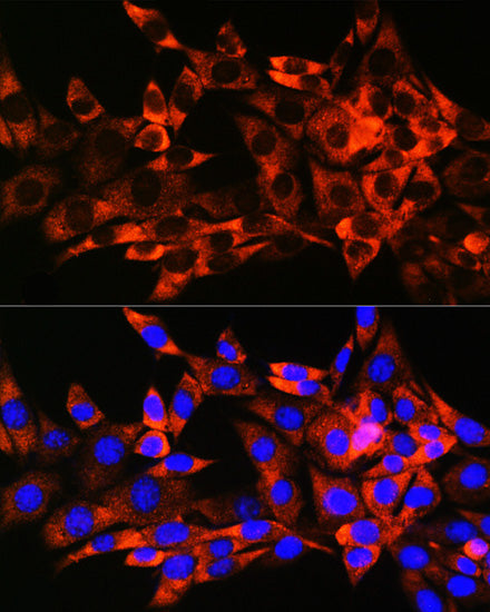 HSPB8/HSP22 Rabbit mAb