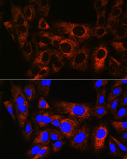 HSPB8/HSP22 Rabbit mAb