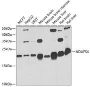 NDUFS4 Rabbit pAb