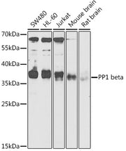 PP1 beta Rabbit pAb