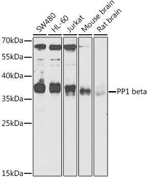 PP1 beta Rabbit pAb