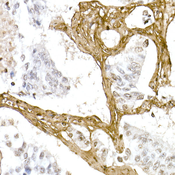 Collagen I/COL1A1 Rabbit pAb