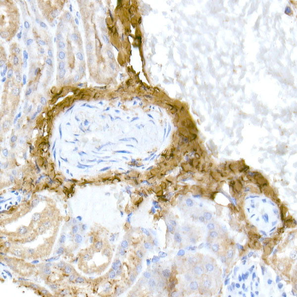 Collagen I/COL1A1 Rabbit pAb