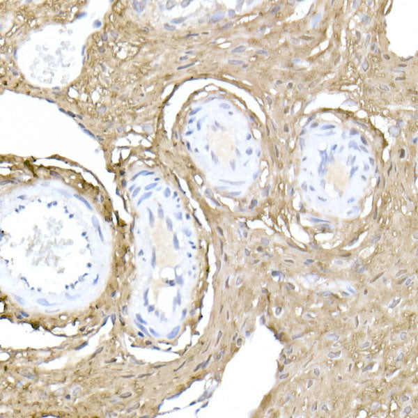 Collagen I/COL1A1 Rabbit pAb