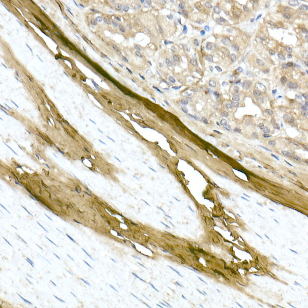 Collagen I/COL1A1 Rabbit pAb