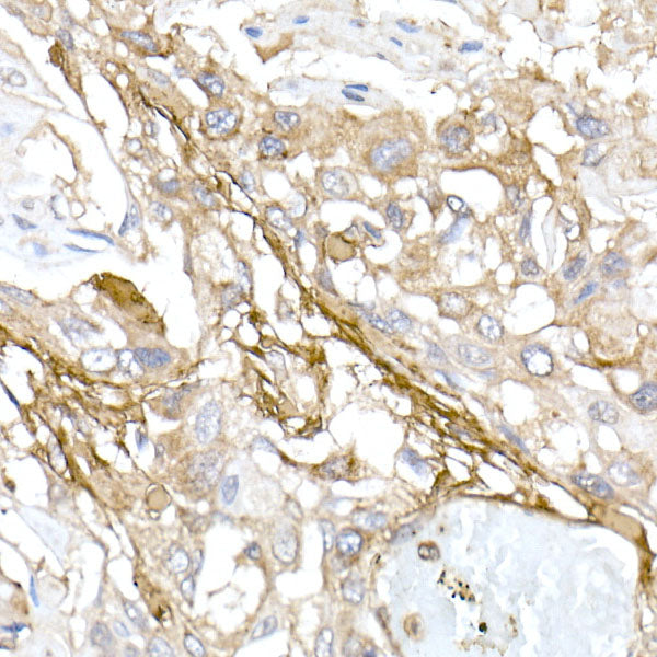 Collagen I/COL1A1 Rabbit pAb