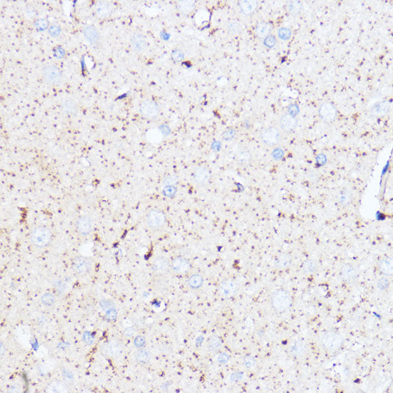 Monoamine Oxidase A (MAOA) Rabbit pAb
