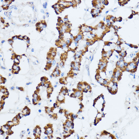 Monoamine Oxidase A (MAOA) Rabbit pAb