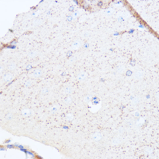 Monoamine Oxidase A (MAOA) Rabbit pAb