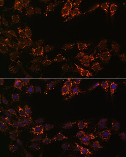 Monoamine Oxidase A (MAOA) Rabbit pAb