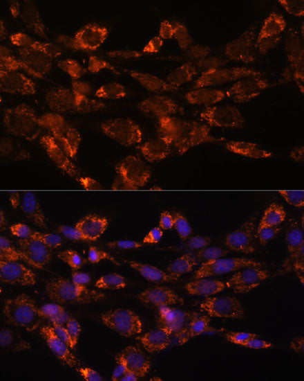 Monoamine Oxidase A (MAOA) Rabbit pAb