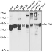 TALDO1 Rabbit pAb