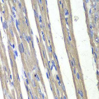 AKR1C3 Rabbit pAb
