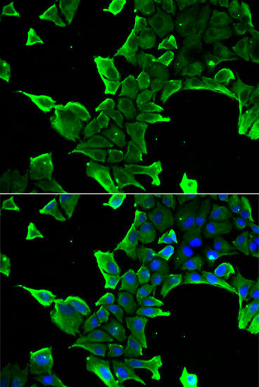 NCS1 Rabbit pAb
