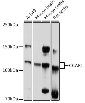 CCAR1 Rabbit pAb