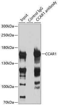 CCAR1 Rabbit pAb