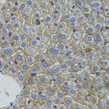 Mitofusin 2 Rabbit pAb