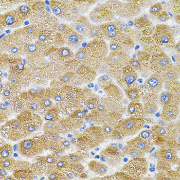 Mitofusin 2 Rabbit pAb