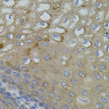 Mitofusin 2 Rabbit pAb