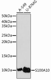 S100A10 Rabbit mAb