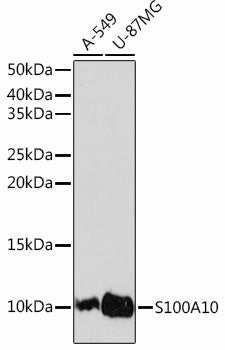 S100A10 Rabbit mAb