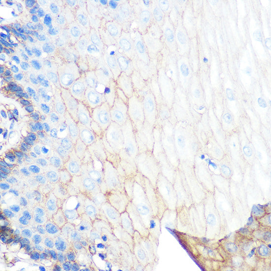 S100A10 Rabbit mAb