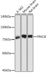 PKC-beta Rabbit pAb