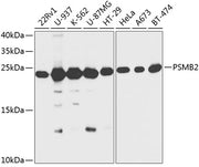 PSMB2 Rabbit pAb