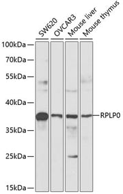 RPLP0 Rabbit pAb
