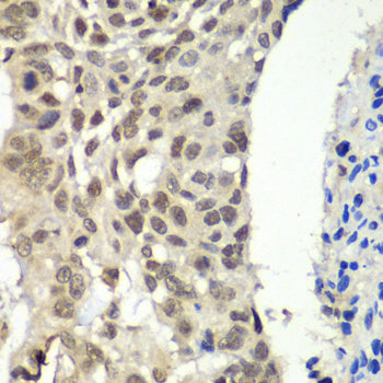 SSRP1 Rabbit pAb