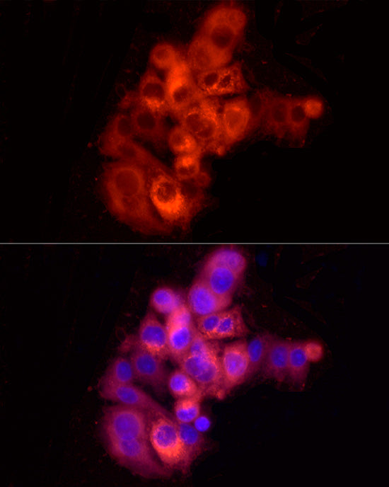 Albumin Rabbit pAb