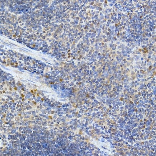 MDA5 Rabbit pAb