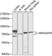 ARHGAP25 Rabbit pAb