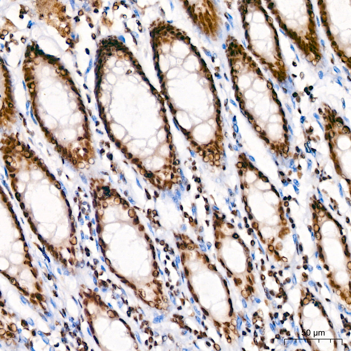 KLF4 Rabbit mAb