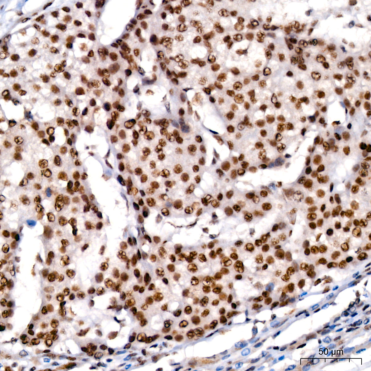 KLF4 Rabbit mAb