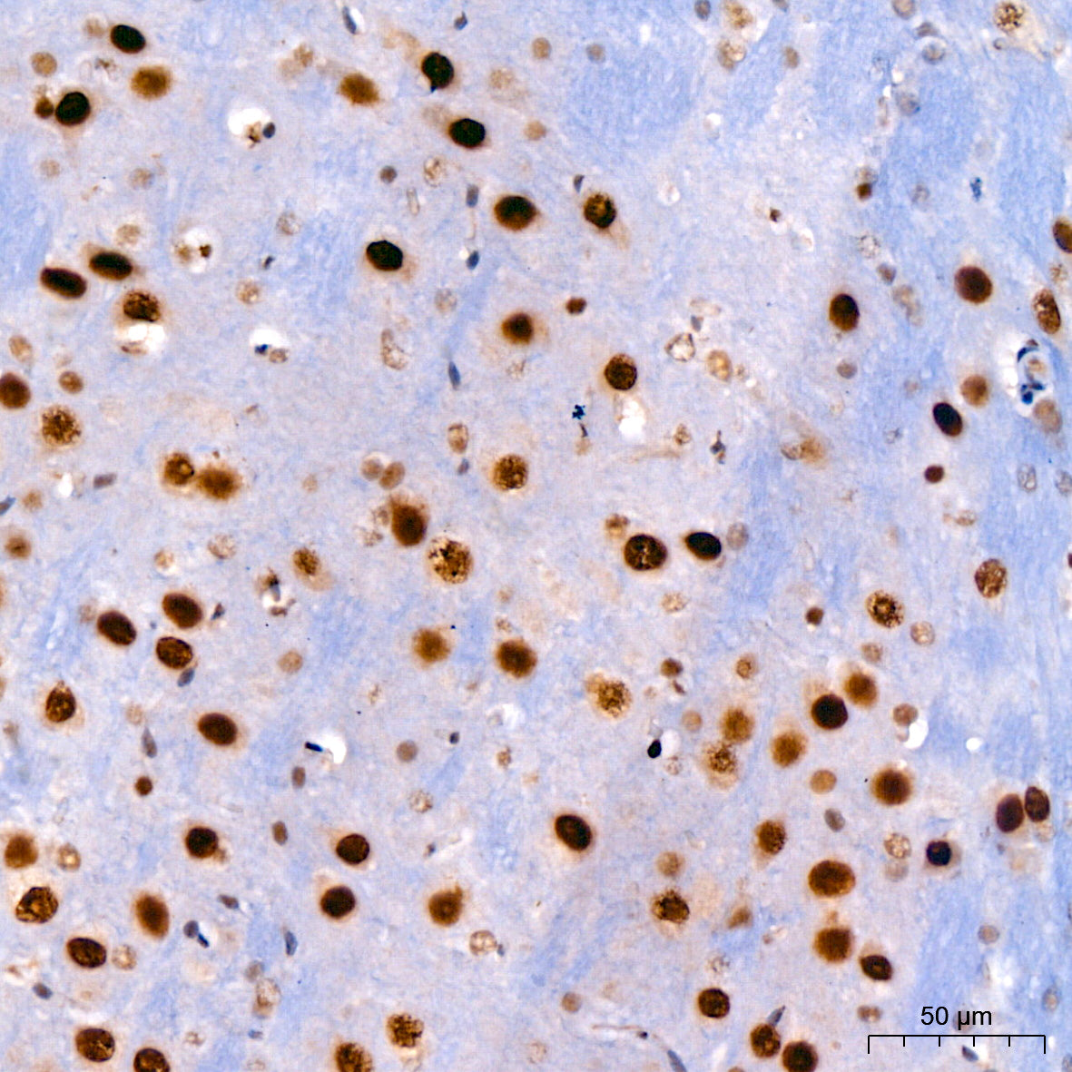 KLF4 Rabbit mAb