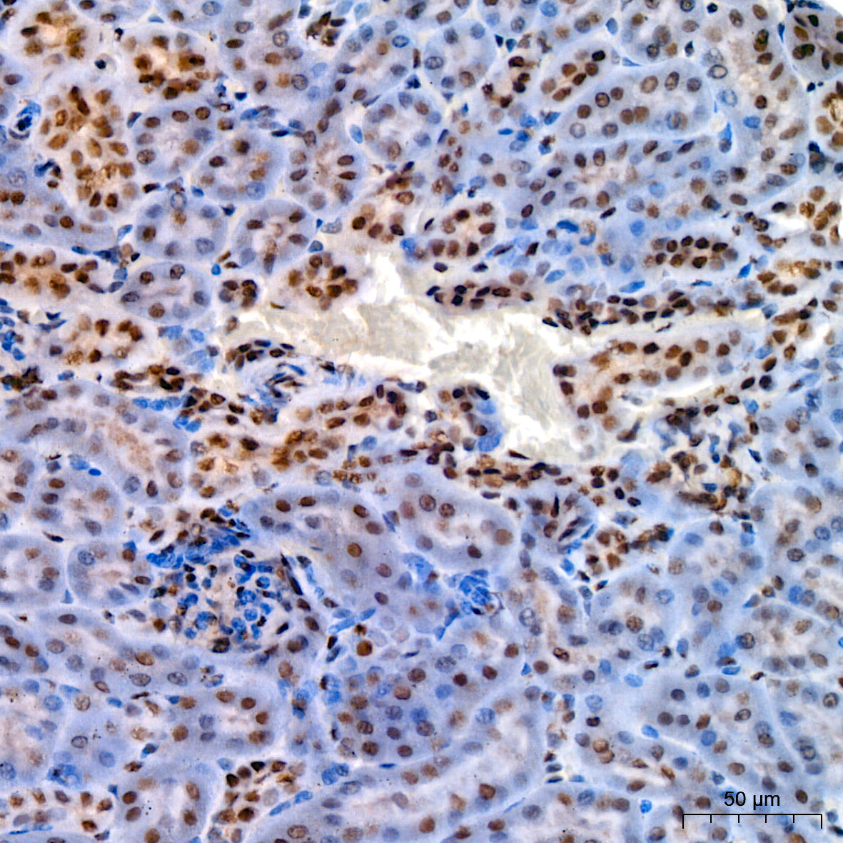 KLF4 Rabbit mAb
