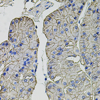 Carbonic Anhydrase 9 (CA9/G250) Rabbit pAb