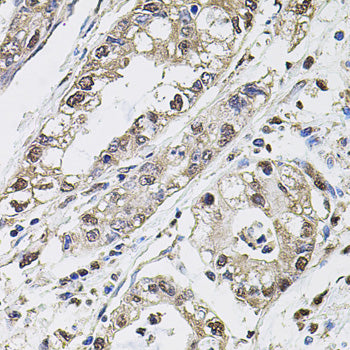 Carbonic Anhydrase 9 (CA9/G250) Rabbit pAb