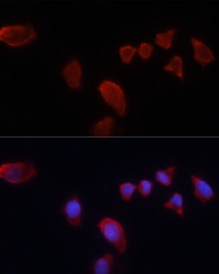 Carbonic Anhydrase 9 (CA9/G250) Rabbit pAb