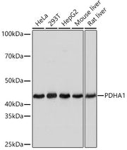 PDHA1 Rabbit mAb
