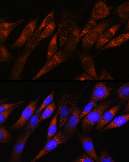 PDHA1 Rabbit mAb