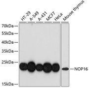 NOP16 Rabbit pAb