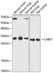 CABP7 Rabbit pAb