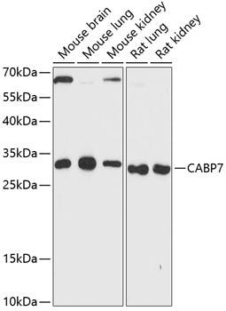 CABP7 Rabbit pAb
