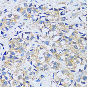 CABP7 Rabbit pAb