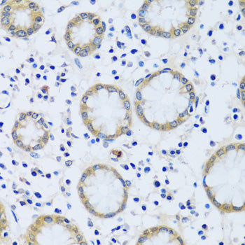 CABP7 Rabbit pAb
