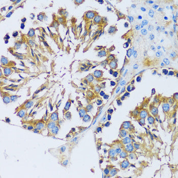CABP7 Rabbit pAb