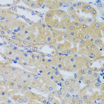 CABP7 Rabbit pAb